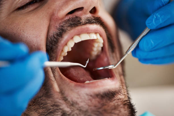 Best Emergency TMJ Treatment in Willards, MD